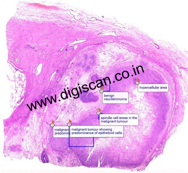 MDS Oral Pathology Exam Cases (Digital Slides & Spot Diagnosis)